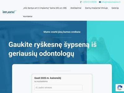 Dantų implantai ir implantacija. Jeigu ieškote kokybės